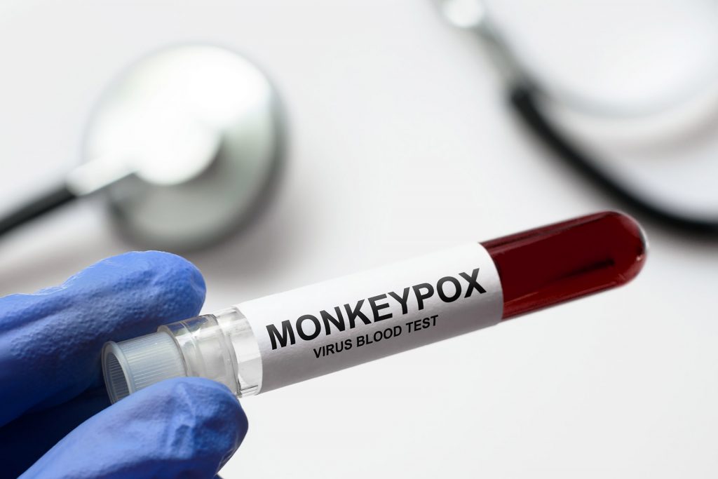 Monkeypox lab testing in xxxyyyzzz ^^
